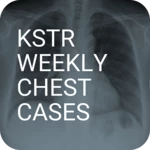 kstr weekly chest cases android application logo